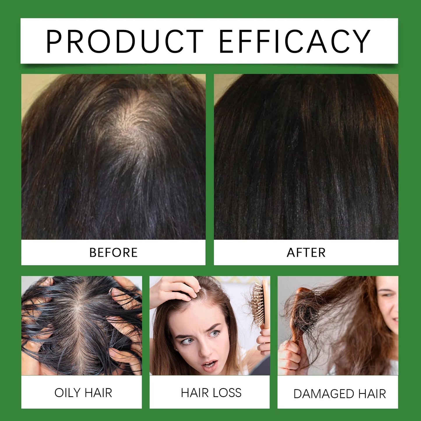 Rosemary Rice Water Hair Spray Nourishes Moisturizes Dry Frizzy Hair Supports Enhances Hair Strength Prevents Breakage