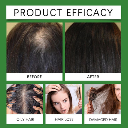 Rosemary Rice Water Hair Spray Nourishes Moisturizes Dry Frizzy Hair Supports Enhances Hair Strength Prevents Breakage