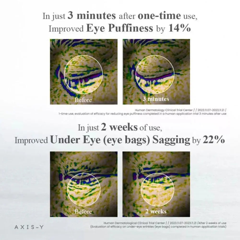 [AXIS-Y] 1/2pcs Collagen Eye Serum Roller Ball Improve Dullness Fade Fine Lines Nourishing Eye Care Stay Up Late Savior